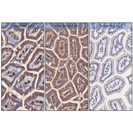 POLYVIEW® (mouse on mouse-HRP) IHC kit